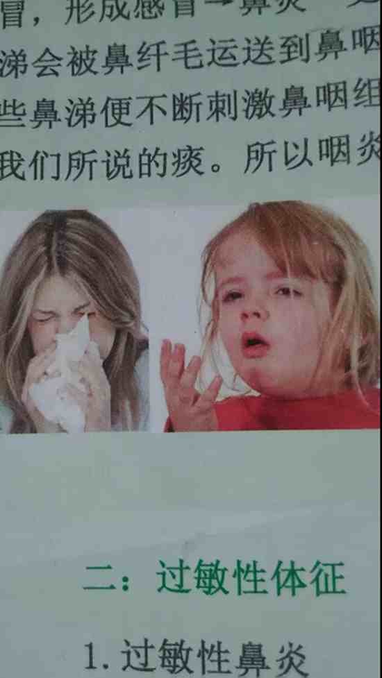 过敏性鼻炎